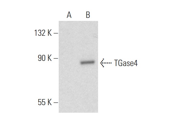 TGase4 (T-19): sc-55791. Western blot analysis of TGase4 expression in non-transfected: sc-110760 (A) and human TGase4 transfected: sc-159015 (B) 293 whole cell lysates.