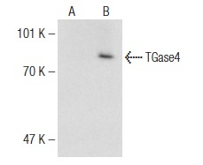 TGase4 (T-19): sc-55791. Western blot analysis of TGase4 expression in non-transfected: sc-110760 (A) and human TGase4 transfected: sc-159015 (B) 293 whole cell lysates.