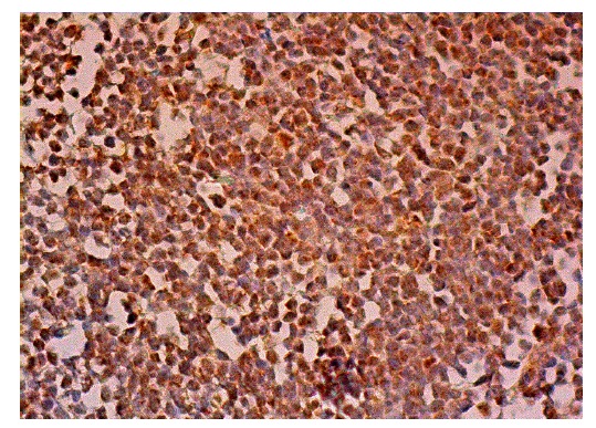 TIA-1 (C-10): sc-166246. Immunoperoxidase staining of formalin fixed, paraffin-embedded human lymph node tissue showing nuclear and cytoplasmic staining of cells in germinal centers and cells in non-germinal centers.