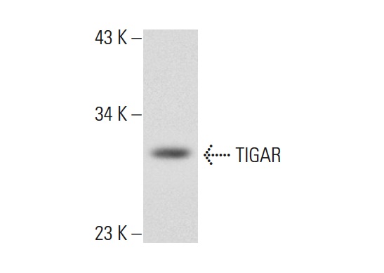 TIGAR (Y-20): sc-68239. Western blot analysis of TIGAR expression in Hep G2 whole cell lysate.