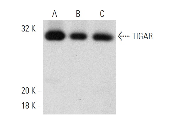 TIGAR (Y-20): sc-68239. Western blot analysis of TIGAR expression in HeLa (A), Hep G2 (B) and Saos-2 (C) whole cell lysates.