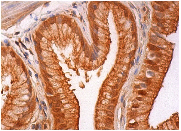 TIGAR (Y-20): sc-68239. Immunoperoxidase staining of formalin fixed, paraffin-embedded human gall bladder tissue showing nuclear and cytoplasmic staining of glandular cells.