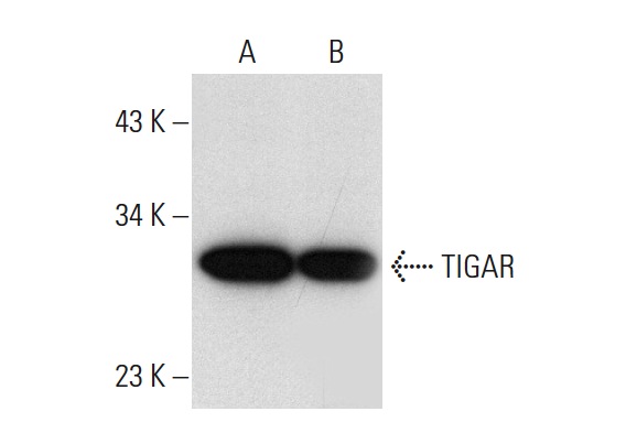 TIGAR (E-2): sc-166290. Western blot analysis of TIGAR expression in U-2 OS (A) and HeLa (B) whole cell lysates.