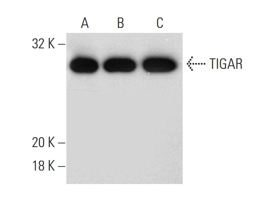 TIGAR (E-2): sc-166290. Western blot analysis of TIGAR expression in Jurkat (A), Hep G2 (B) and Saos-2 (C) whole cell lysates.