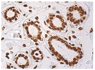 TIGAR (E-2): sc-166290. Immunoperoxidase staining of formalin fixed, paraffin-embedded human breast tissue showing nuclear and cytoplasmic staining of glandular cells.