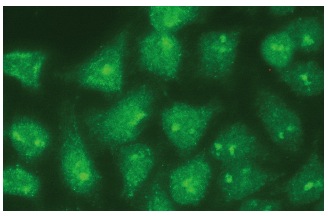 TIGAR (E-10): sc-166291. Immunofluorescence staining of methanol-fixed HeLa cells showing nuclear and cytoplasmic localization.