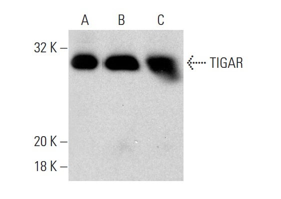 TIGAR (E-10): sc-166291. Western blot analysis of TIGAR expression in Jurkat (A), Hep G2 (B) and Saos-2 (C) whole cell lysates.