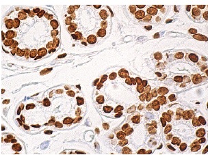 TIGAR (E-10): sc-166291. Immunoperoxidase staining of formalin fixed, paraffin-embedded human breast tissue showing nuclear staining of glandular cells.