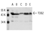 TOB2 (N-20): sc-18551. Western blot analysis of TOB2 expression in HeLa (A), NIH/3T3 (B), Ramos (C), IB4 (D) and K-562 (E) whole cell lysates.