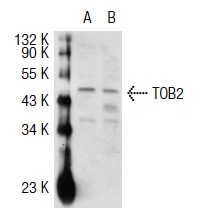 TOB2 (N-20): sc-18551. Western blot analysis of TOB2 expression in non-transfected: sc-117752 (A) and human TOB2 transfected: sc-124209 (B) 293T whole cell lysates.