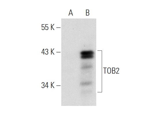 TOB2 (N-20): sc-18551. Western blot analysis of TOB2 expression in non-transfected: sc-117752 (A) and mouse TOB2 transfected: sc-124210 (B) 293T whole cell lysates.