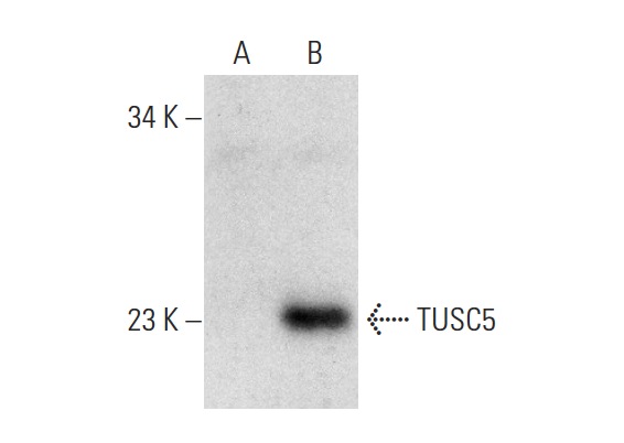 TUSC5 (H-102): sc-292061. Western blot analysis of TUSC5 expression in non-transfected: sc-117752 (A) and human TUSC5 transfected: sc-112682 (B) whole cell lysates.