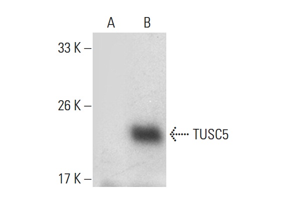 TUSC5 (H-102): sc-292061. Western blot analysis of TUSC5 expression in non-transfected: sc-117752 (A) and human TUSC5 transfected: sc-112682 (B) 293T whole cell lysates.