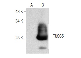 TUSC5 (M-110): sc-292062. Western blot analysis of TUSC5 expression in non-transfected: sc-117752 (A) and human TUSC5 transfected: sc-112682 (B) 293T whole cell lysates.