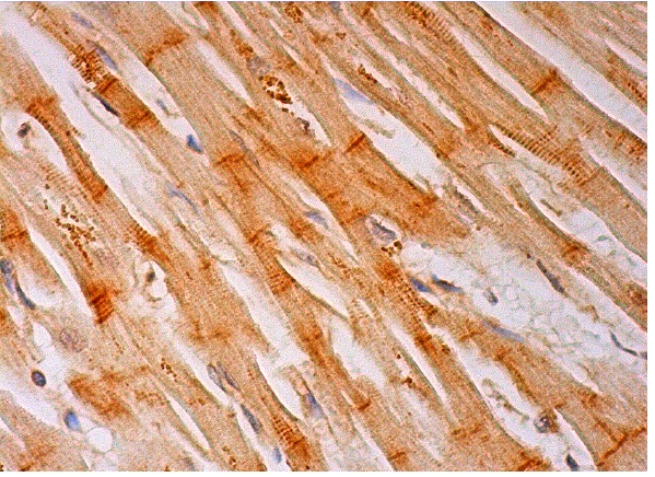 TUSC5 (M-110): sc-292062. Immunoperoxidase staining of formalin fixed, paraffin-embedded human heart muscle tissue showing cytoplasmic and membrane staining of myocytes.