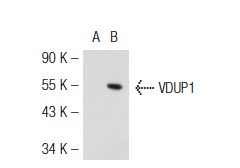 VDUP1 (C-18): sc-33099. Western blot analysis of VDUP1 expression in non-transfected: sc-117752 (A) and mouse VDUP1 transfected: sc-124550 (B) 293T whole cell lysates.