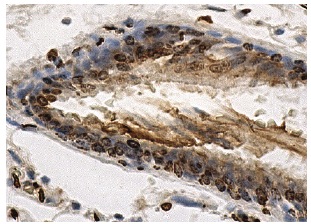 VDUP1 (C-18): sc-33099. Immunoperoxidase staining of formalin fixed, paraffin-embedded human lung tissue showing nuclear and cytoplasmic staining of respiratory epithelial cells.