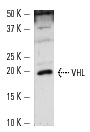 VHL (FL-181): sc-5575. Western blot analysis of VHL expression in F9 whole cell lysate.