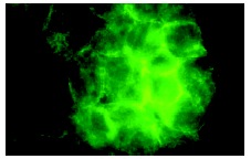 VHL (FL-181): sc-5575. Immunofluorescence staining of methanol-fixed F9 cells showing membrane localization.