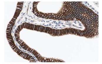 VHL (FL-181): sc-5575. Immunoperoxidase staining of formalin fixed, paraffin-embedded human gall bladder tissue showing cytoplasmic staining of glandular cells at high magnification. Kindly provided by The Swedish Human Protein Atlas (HPA) program.