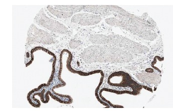 VHL (FL-181): sc-5575. Immunoperoxidase staining of formalin fixed, paraffin-embedded human gall bladder tissue showing cytoplasmic staining of glandular cells at low magnification. Kindly provided by The Swedish Human Protein Atlas (HPA) program.