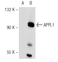 APPL1 (H-96): sc-67402. Western blot analysis of APPL1 expression in non-transfected: sc-117752 (A) and mouse APPL1 transfected: sc-118501 (B) 293T whole cell lysates.