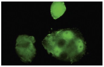 BOLA1 (32.2): sc-81824. Immunofluorescence staining of paraformaldehyde-fixed MCF7 cells showing nuclear and cytoplasmic localization.