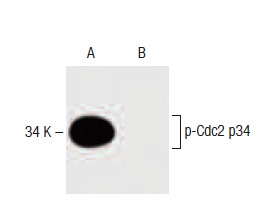 p-Cdc2 p34 (pY15.44): sc-136014. Western blot analysis of Cdc2 p34 phosphorylation in untreated (A) and alkaline phosphatase-treated (B) Saos-2 whole cell lysates.