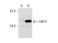 Cdk10 (C-19): sc-51266. Western blot analysis of Cdk10 expression in non-transfected: sc-117752 (A) and human Cdk10 transfected: sc-128293 (B) 293T whole cell lysates.