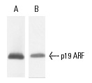 Western blot analysis of p19 ARF expression in wtMEFp6 whole cell lysates. Antibodies tested include p19 ARF (5-C3-1): sc-32748 (A) and p19 ARF (12-A1-1): sc-32749 (B). Kindly provided by St. Jude Children's Hospital.