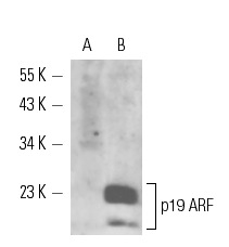 p19 ARF (5-C3-1): sc-32748. Western blot analysis of p19 ARF expression in NIH/3T3.C9 (p19 ARF NULL) (A) and p53 -/- MEF (high expression of p19 ARF) (B) whole cell lysates.