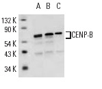 CENP-B (H-65): sc-22788. Western blot analysis of CENP-B expression in HeLa + etopside (A), A-431 (B) and Jurkat (C) whole cell lysates.
