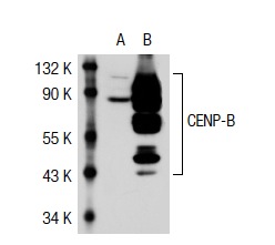 CENP-B (H-65): sc-22788. Western blot analysis of CENP-B expression in non-transfected: sc-117752 (A) and human CENP-B transfected: sc-116535 (B) 293T whole cell lysates.