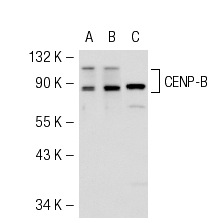 CENP-B (H-65): sc-22788. Western blot analysis of CENP-B expression in non-transfected 293T: sc-117752 (A), mouse CENP-B transfected 293T: sc-126626 (B) and A-431 (C) whole cell lysates.