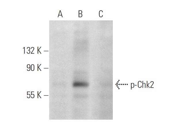 p-Chk2 (Thr 68)-R: sc-16297-R. Western blot analysis of Cdc2 p34 phosphorylation in untreated (A), UV irradiated (B) and UV irradiated and lambda protein phosphatase treated (C) HeLa whole cell lysates.