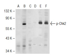 Western blot analysis of Chk2 phosphorylation in untreated (A,D), UV irradiated (B,E) and UV irradiated and lambda protein phosphatase treated (C,F) HeLa whole cell lysates. Antibodies tested include p-Chk2 (Thr 68)-R: sc-16297-R (A,B,C) and Chk2 (C-18): sc-8813 (D,E,F).