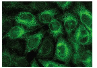 cyclin B2 (H-105): sc-22776. Immunofluorescence staining of methanol-fixed HeLa cells showing membrane and cytplasmic localization.