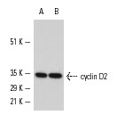 cyclin D2 (M-20): sc-593. Western blot analysis of cyclin D2 expression in MM-142 nuclear extract (A,B).