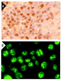 cyclin D2 (M-20): sc-593. Immunoperoxidase staining of formalin fixed, paraffin-embedded mouse ovary (A) and immunofluorescence staining of methanol-fixed MM-142 cells (B) showing nuclear localization.
