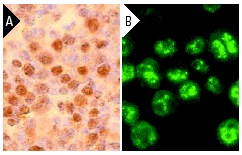 cyclin D2 (M-20): sc-593. Immunoperoxidase staining of formalin fixed, paraffin-embedded mouse ovary (A) and immunofluorescence staining of methanol-fixed MM-142 cells (B) showing nuclear localization.