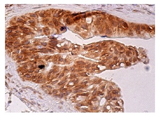 MAD1 (D-1): sc-166312. Immunoperoxidase staining of formalin fixed, paraffin-embedded human gall bladder tissue showing nuclear envelope and cytoplasmic staining of glandular cells.