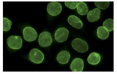 MAD1 (9B10): sc-47746. Immunofluorescence staining of methanol-fixed HeLa cells showing nuclear localization.