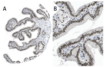 MAD1 (9B10): sc-47746. Immunoperoxidase staining of formalin fixed, paraffin-embedded human gall bladder tissue showing nuclear membrane staining of glandular cells (low and high magnification). Kindly provided by The Swedish Human Protein Atlas (HPA) program.