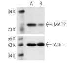 MAD2 siRNA (h): sc-35837. Western blot analysis of MAD2 expression in non-transfected control (A) and MAD2 siRNA transfected (B) HeLa cells. Blot probed with MAD2 (C-19): sc-6329. Actin (I-19): sc-1616 used as specificity and loading control.