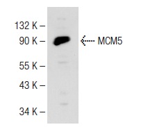 MCM5 (E-10): sc-165994. Western blot analysis of MCM5 expression in HeLa nuclear extract.