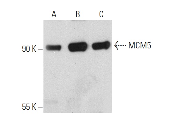 MCM5 (E-10): sc-165994. Western blot analysis of MCM5 expression in COLO 320DM (A), K-562 (B) and HeLa (C) whole cell lysates.