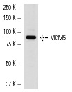 MCM5 (H-300): sc-22780. Western blot analysis of MCM5 expression in HL-60 nuclear extract.