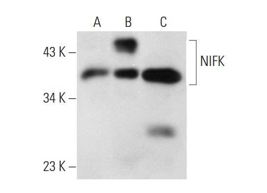 NIFK (18E148): sc-52904. Western blot analysis of NIFK expression in non-transfected 293T: sc-117752 (A), human NIFK transfected 293T: sc-170742 (B) and Ramos (C) whole cell lysates.