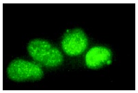 p21 (H-164): sc-756. Immunofluorescence staining of methanol-fixed C32 cells showing nuclear staining.