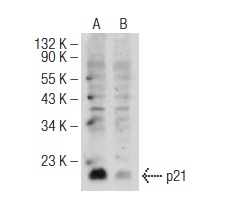 p21 (H-164): sc-756. Western blot analysis of p21 expression in untreated (A) and Novobiocin Sodium (U-6591) (sc-358734) treated (B) T-47D whole cell lysates. Note down regulation of p21 expression in lane B.
